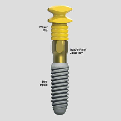 Impression Components - Complete Dental Implant Solutions